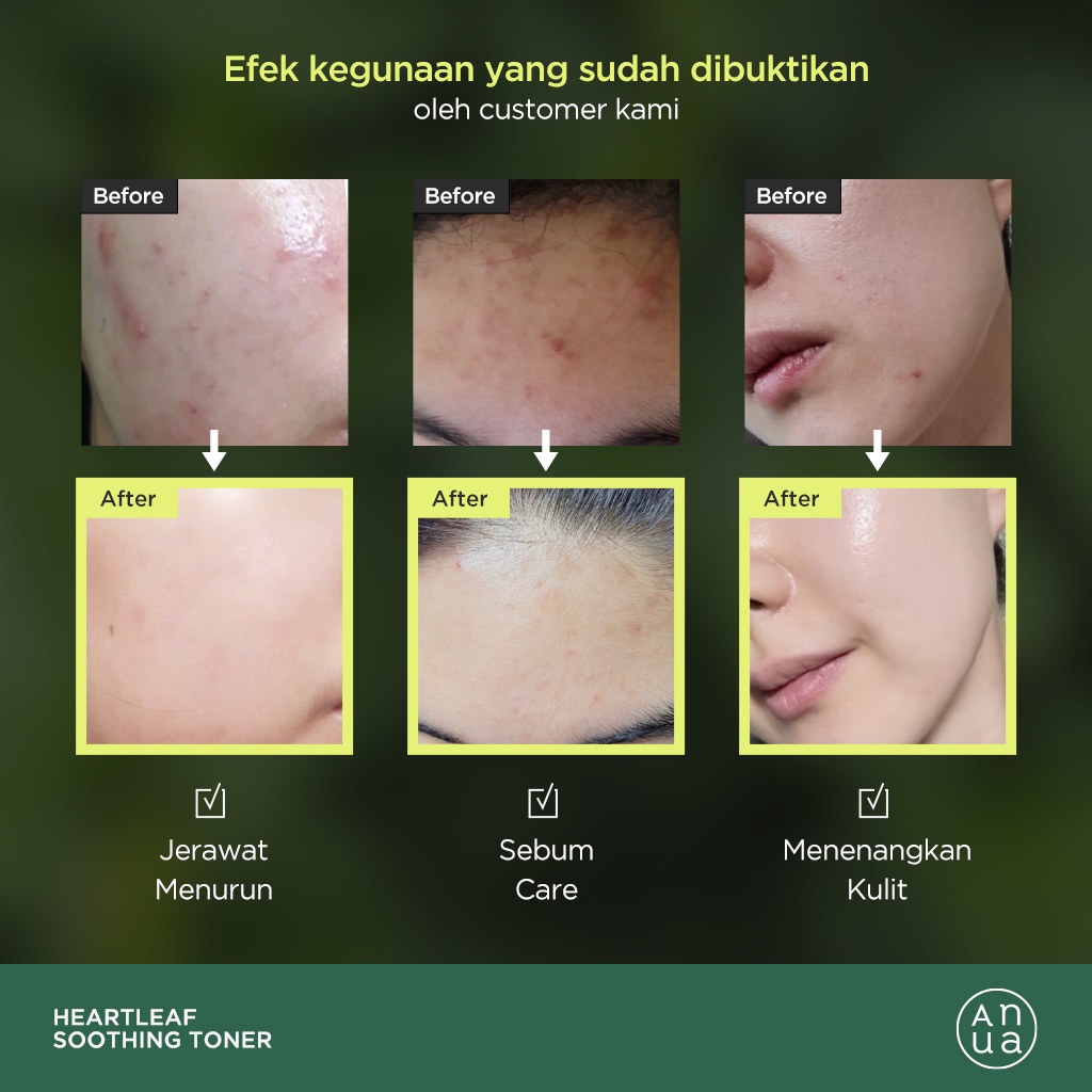 ANUA Heartleaf 77% Soothing Toner