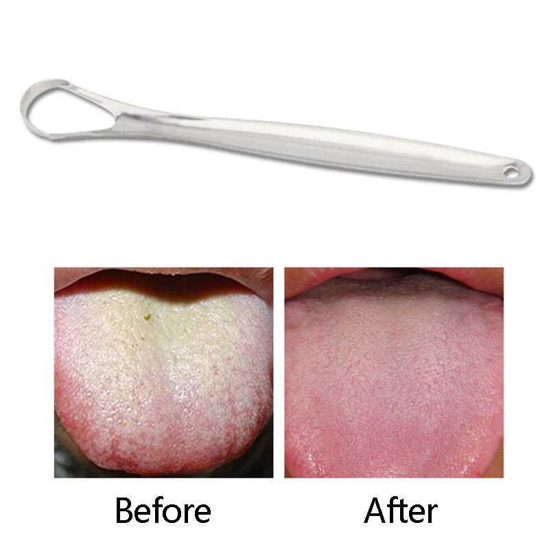 FourSoft Pembersih Lidah Tongue Oral Scraper Stainless Steel - Membersihkan Lidah dengan Maksimal, Anti Karat