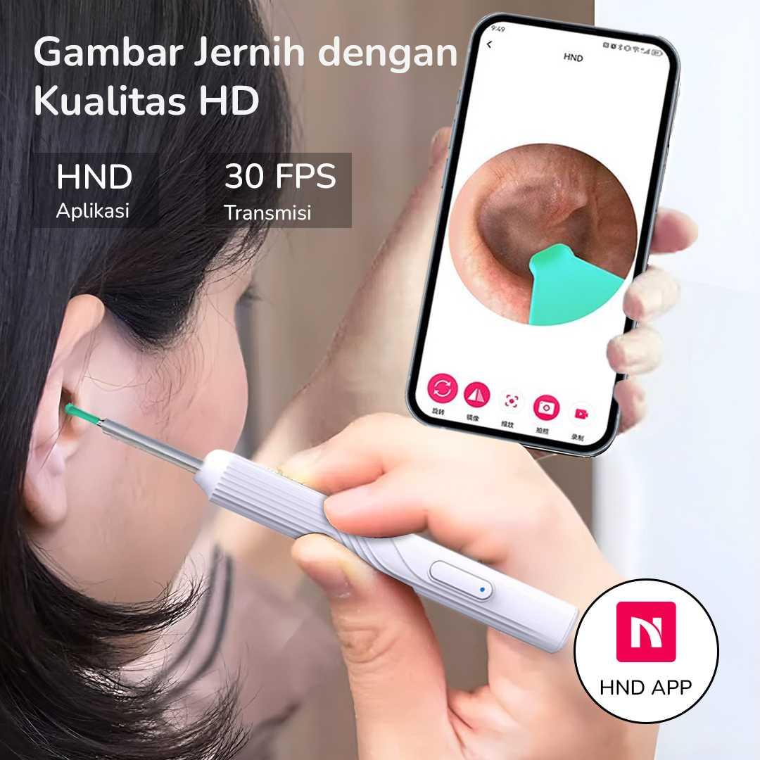 NATFIRE Kamera Endoskopi Pembersih Telinga Otoskop Endoscope - Pembersihan Telinga Jadi Aman dan Presisi, Visual HD Real Time
