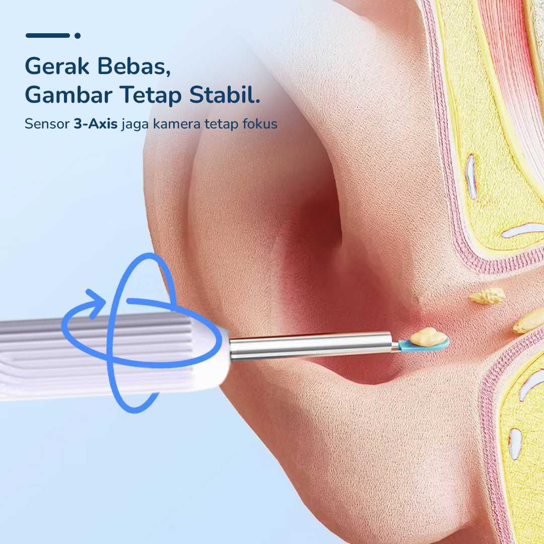 NATFIRE Kamera Endoskopi Pembersih Telinga Otoskop Endoscope - Pembersihan Telinga Jadi Aman dan Presisi, Visual HD Real Time