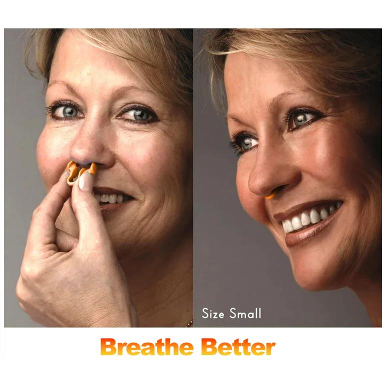 Sleepease Nasal Dilator Anti Snoring - Solusi Nyenyak Tanpa Dengkuran, Desain Ergonomis