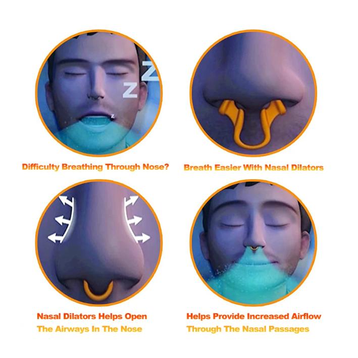 Sleepease Nasal Dilator Anti Snoring - Solusi Nyenyak Tanpa Dengkuran, Desain Ergonomis