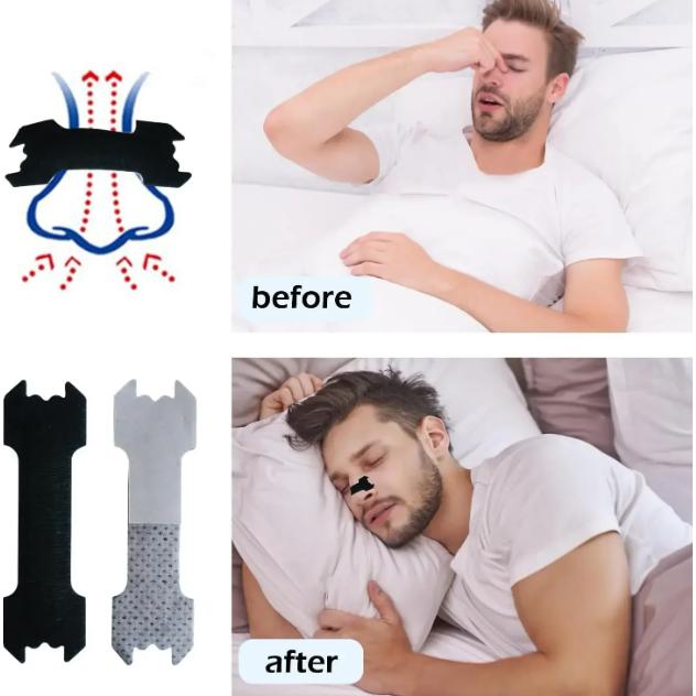 Brease Nasal Strips Patch Dilator Anti Snoring - Tidur Nyenyak Tanpa Dengkuran, Solusi Sleep Apnea, Mudah Digunakan - SL2