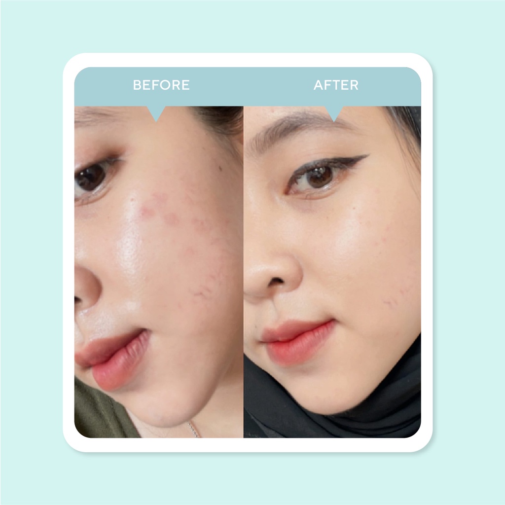 Mugwort Cica Essence Toner - Soothing & Hydrating