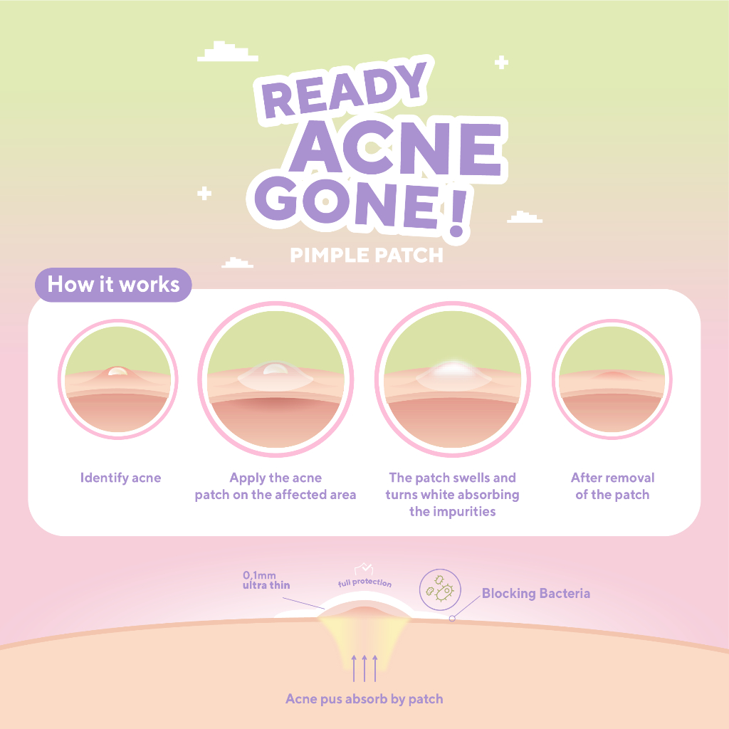 [ NEW ] True to Skin - Ready Acne Gone! Pimple Patch 15pcs Ultra Thin - Sticker penghilang jerawat dgn Centella Asiatica, Salicylic Acid, Tea Tree