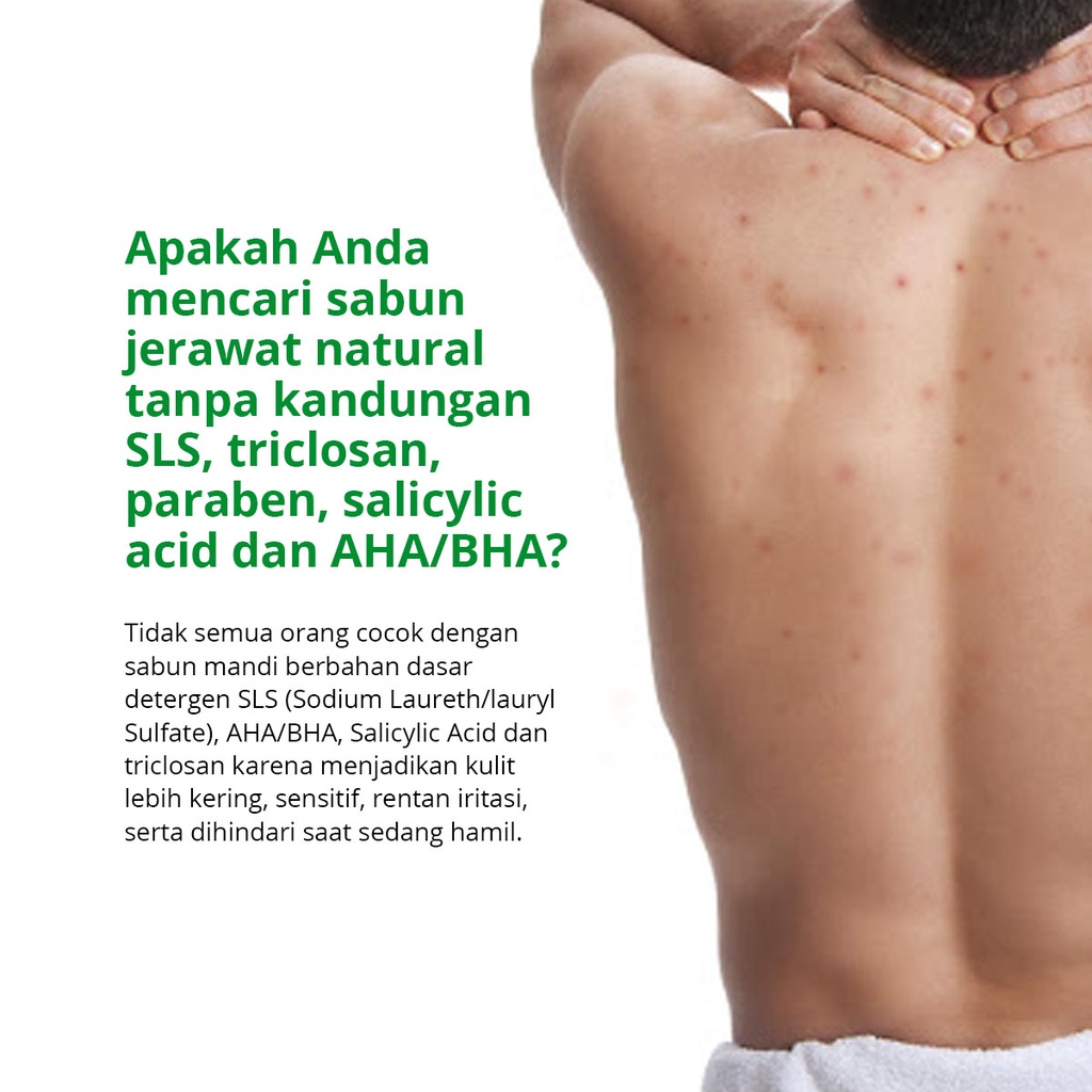 Acne Herbal Solution Natural Castile Soap Kun Anta!