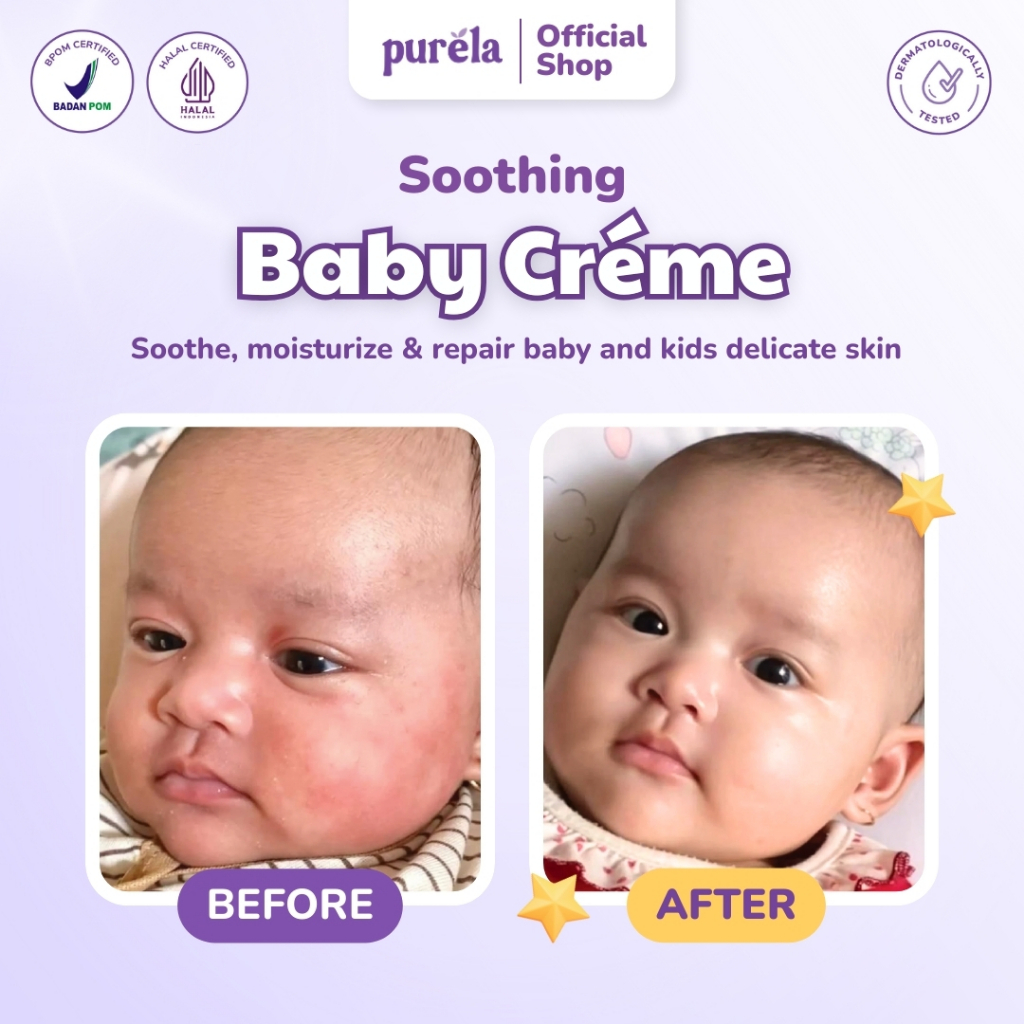 PURELA Soothing Baby Creme 70 gr - Krim untuk Membantu Mengurangi Gatal karena Biang Keringat dan Ruam Popok - Bahan Alami dan Organik