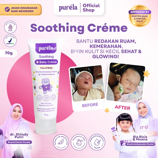 Image of PURELA Soothing Baby Creme 70 gr - Krim Mengatasi Gatal Biang Keringat , Menghaluskan , Mencerahkan