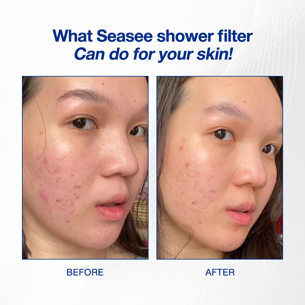 [All Variant] SEASEE Shower Filter Kit - Basic Shower Kit Only