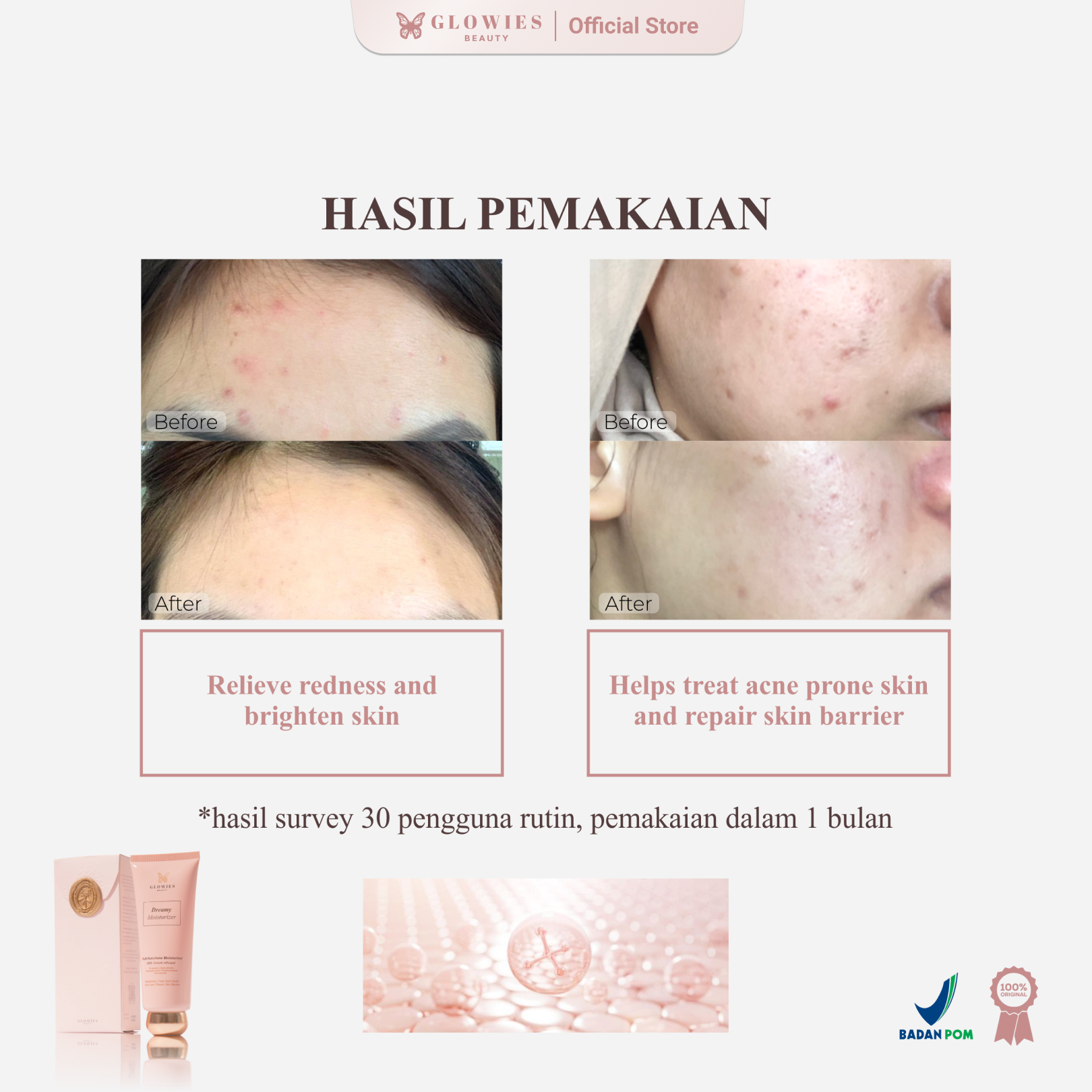 Glowies Beauty Dreamy Moisturizer 80ml 7% Azeclair Niacinimide Alpha Arbutin 5x Ceramide Pelembab wajah Formulasi Korea membantu Mencerahkan Menghilangkan jerawat PIE PIH Memperbaiki Skin Barrier dan Acne Repair Non Comedogenic Busui Friendly
