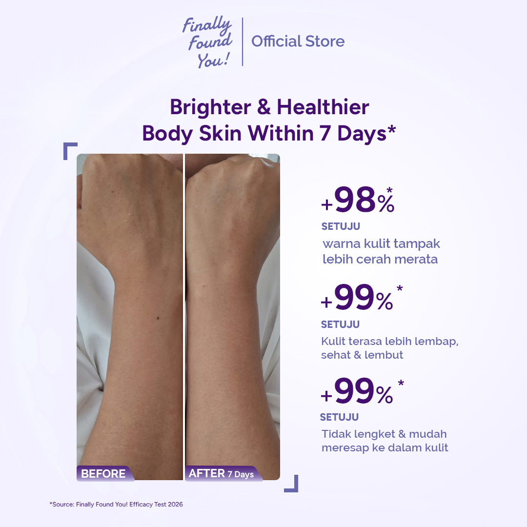 Finally Found You! RICE+ AI High-Concentrated Brightening Body Lotion | Lotion Badan Pencerah dengan 15% Niacinamide untuk Kulit Kusam & Belang