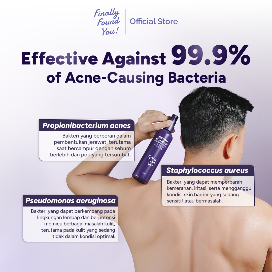 Finally Found You! 200 ppm HOCl Skin Relief Face & Body Spray 250mL | Spray untuk Menenangkan Kulit Berjerawat, Kemerahan, dan Iritasi pada Wajah & Badan