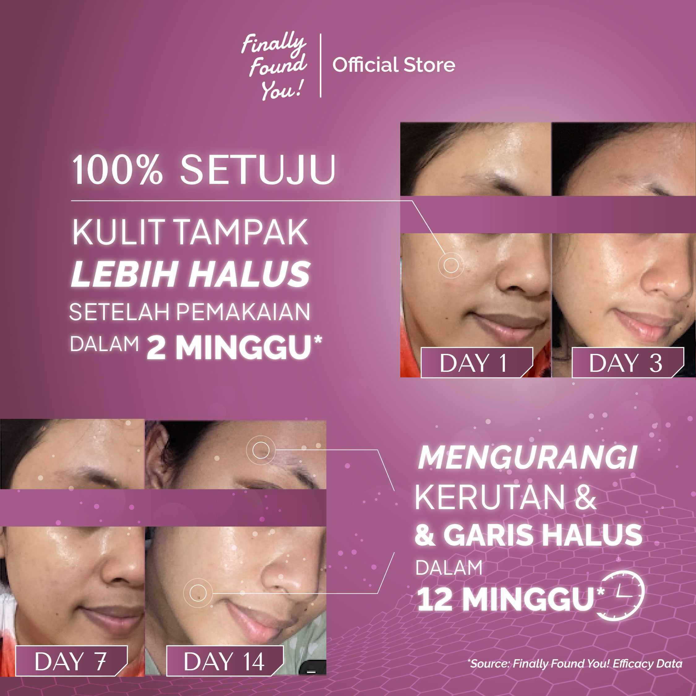 The Ultimate Concentrate Retinal + Rambutan 20mL | Smoothing & Acne Care Serum untuk menghaluskan tekstur kulit dan mengurangi jerawat