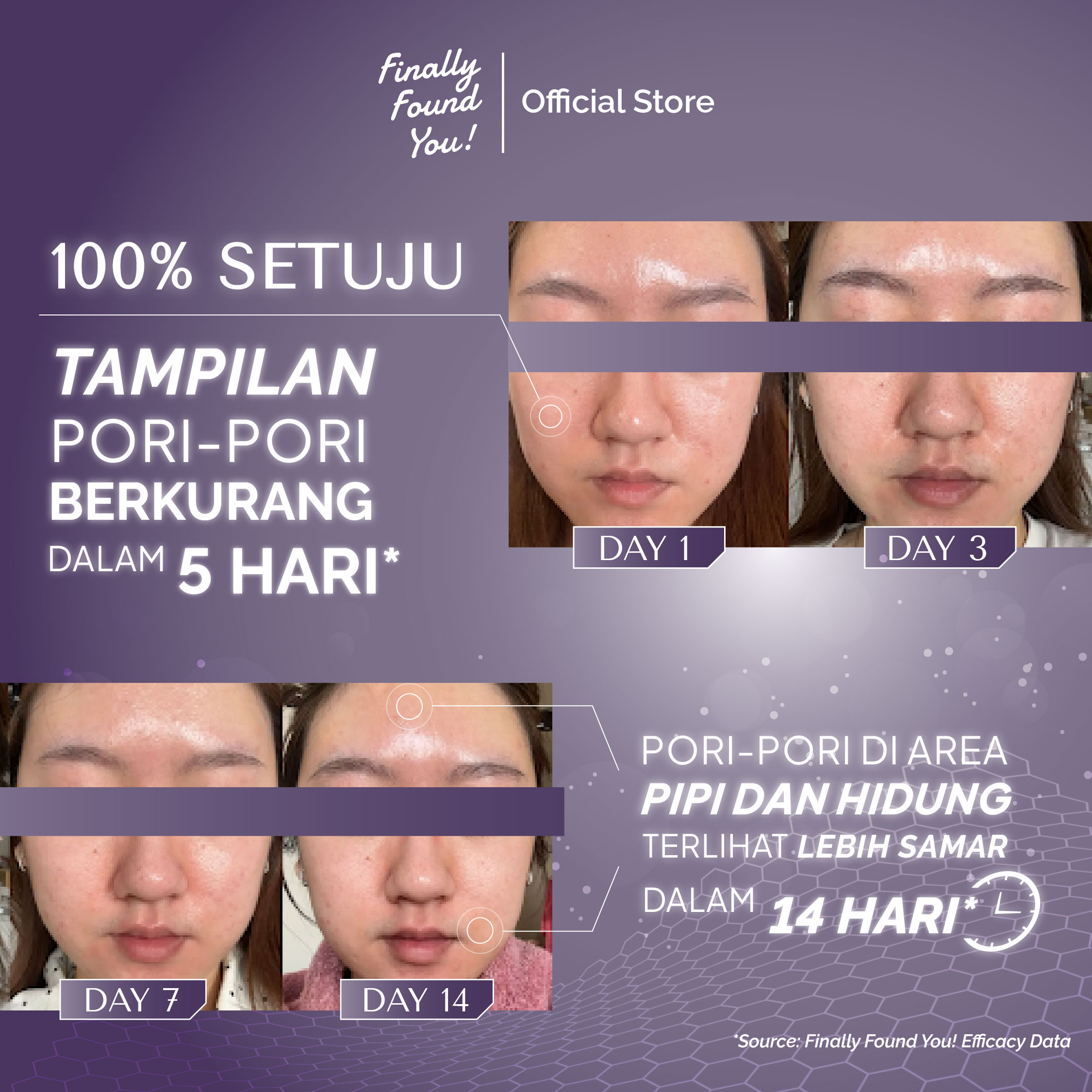 The Ultimate Concentrate NAD + Black Rice 20mL | Pore-Tightening & Brightening Serum untuk membantu mengecilkan pori dan mencerahkan kulit