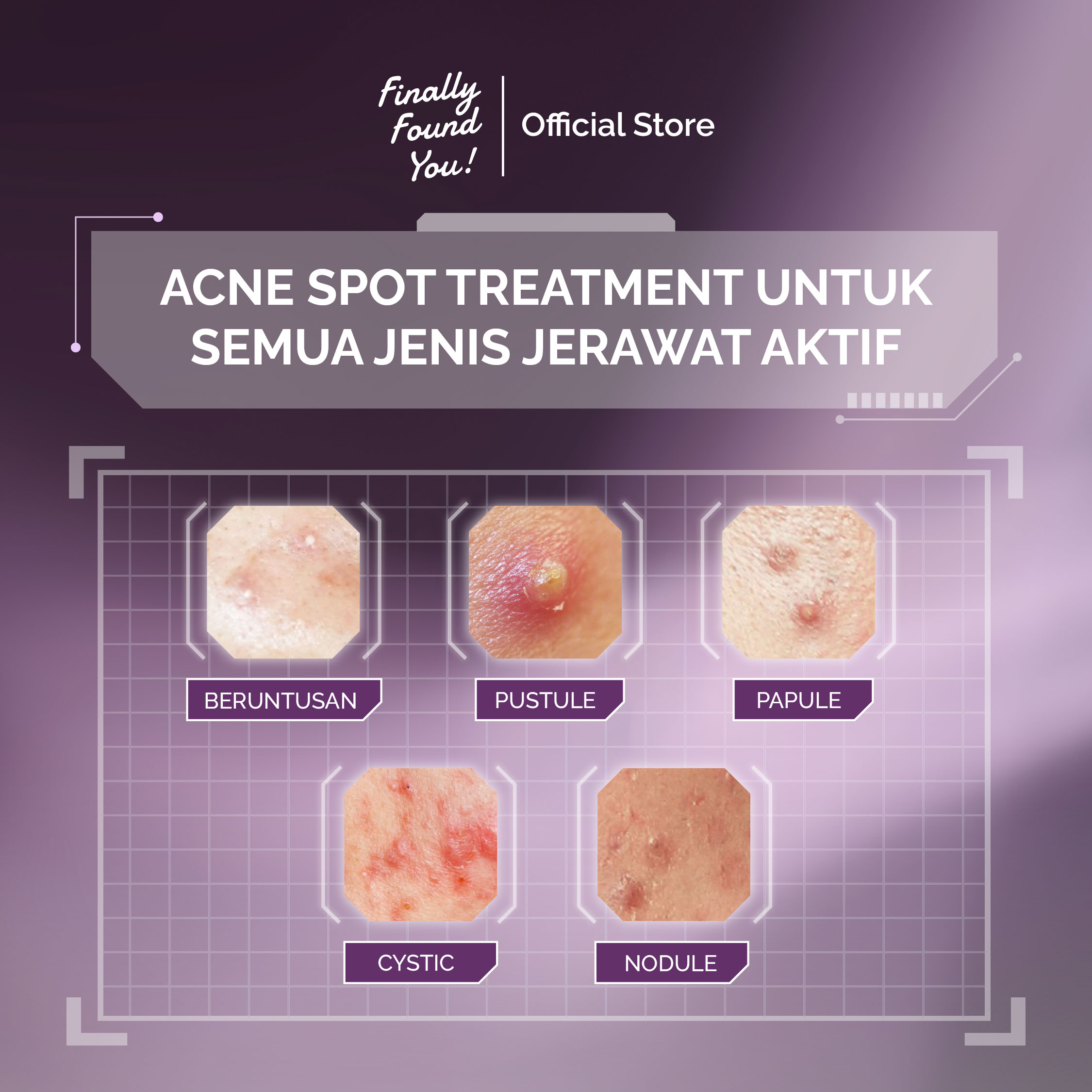 Finally Found You! Acne ProtecTea Spot Treatment 12g | Obat Totol Jerawat Untuk Kulit Sensitif & Berjerawat