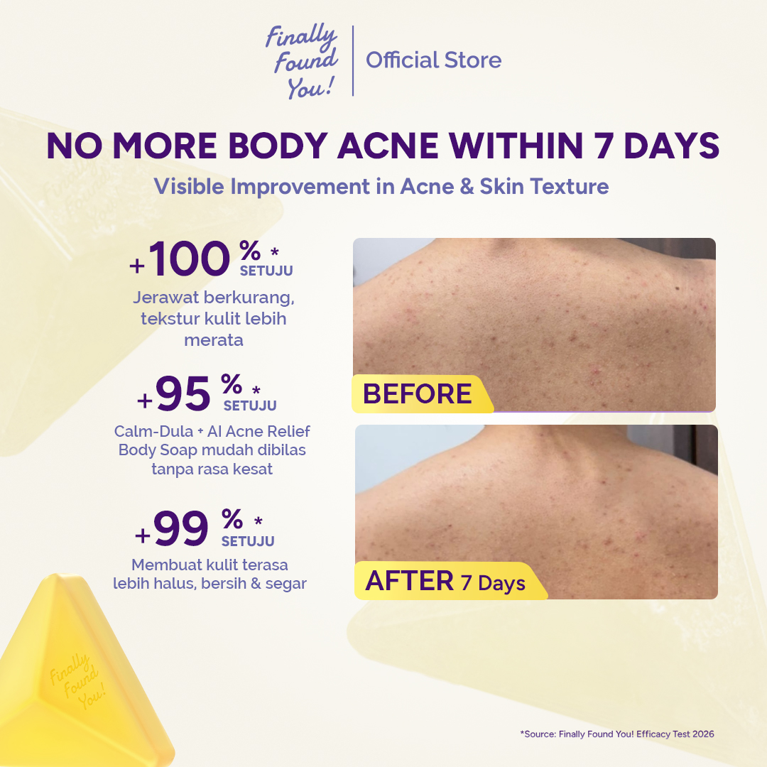 Finally Found You! CALM-DULA + AI Acne Relief Body Soap | Sabun Badan Anti Jerawat & Menenangkan Kulit Sensitif