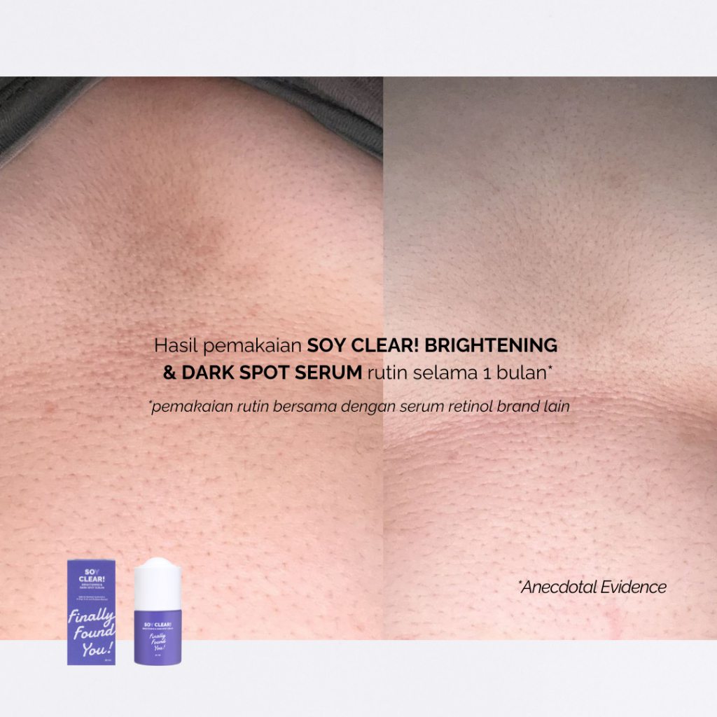 Finally Found You! SOY CLEAR Brightening & Dark Spot Serum - Serum Mencerahkan dan Noda Hitam Untuk Semua Jenis Kulit 20ml
