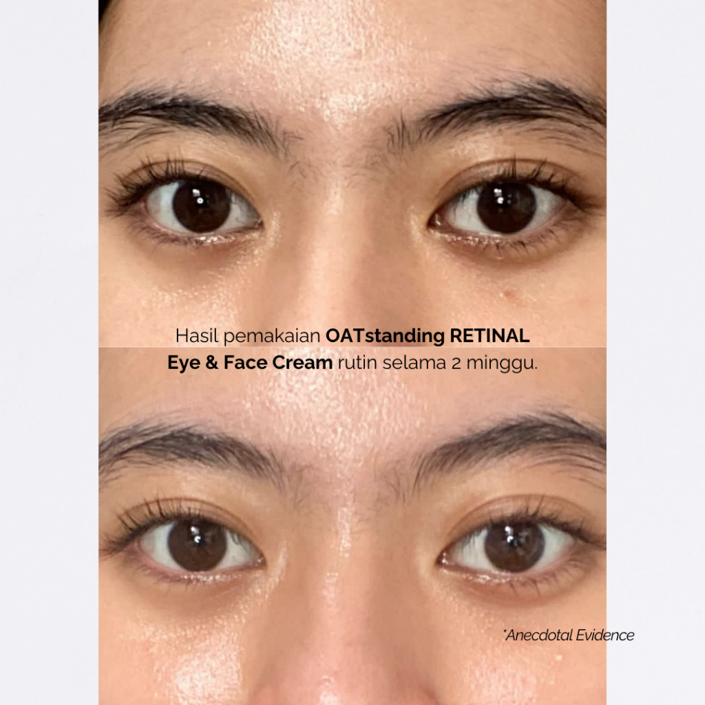 Finally Found You! FFY OATstanding Retinal - 2in1 Eye & Face Cream Krim untuk Mata Panda dan Kerutan 20ml