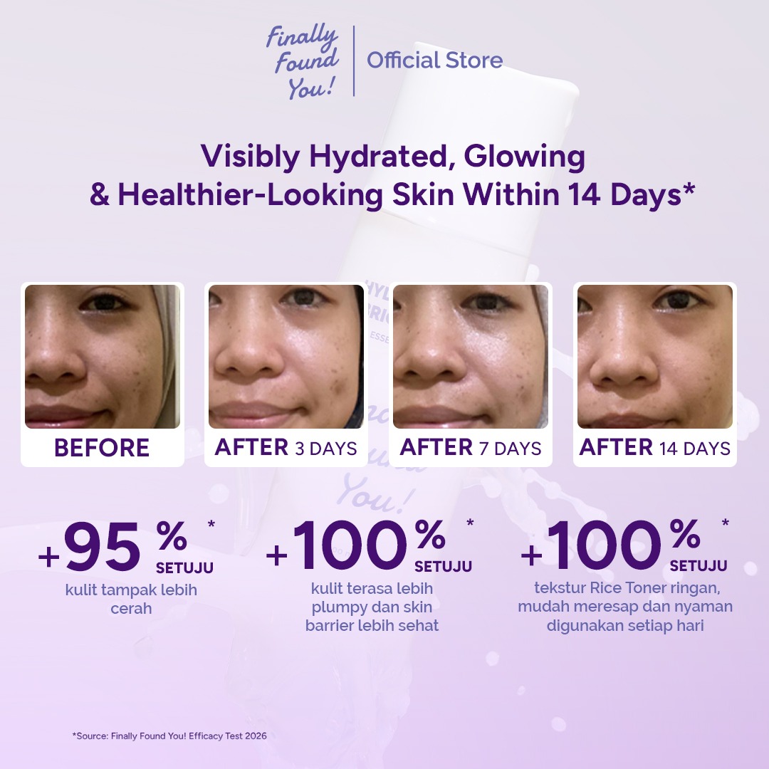 Finally Found You! HYDRICEING & BRIGHTENING Essence Booster - Serum Infused Toner Untuk Semua Jenis Kulit 100mL