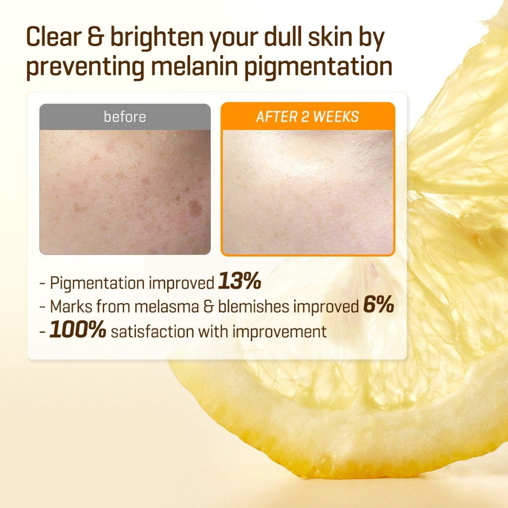 SOME BY MI Yuja Niacin Blemish Cream 60g