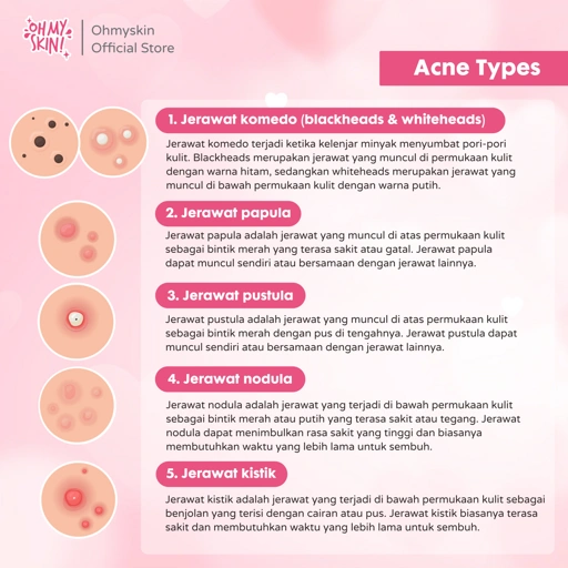 Pimple jinsiy olatni