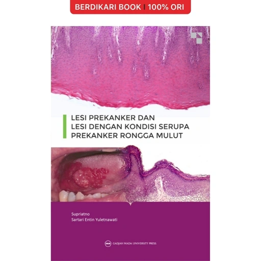 Image of Lesi Prekanker dan Lesi dengan Kondisi Serupa Prekanker Rongga Mulut - UGM Press