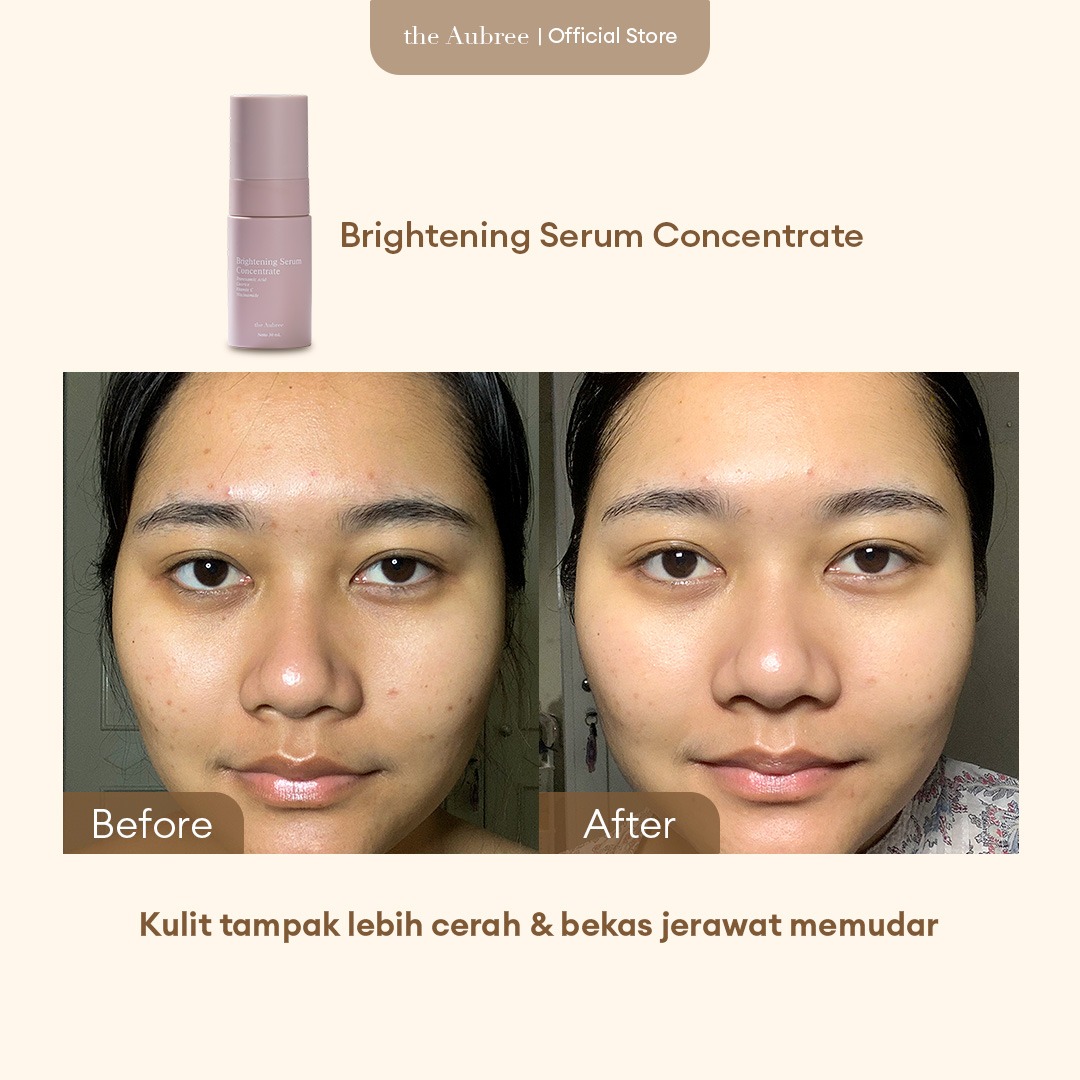 The Aubree Brightening Serum Concentrate 30mL Serum Mencerahkan New Packaging
