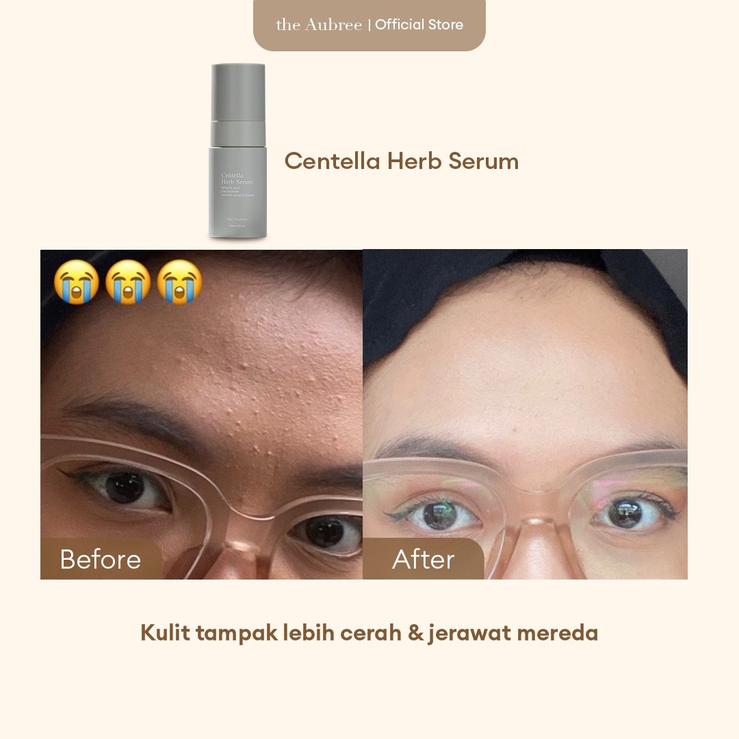 The Aubree Centella Herb Serum 30 ml Serum Anti Jerawat