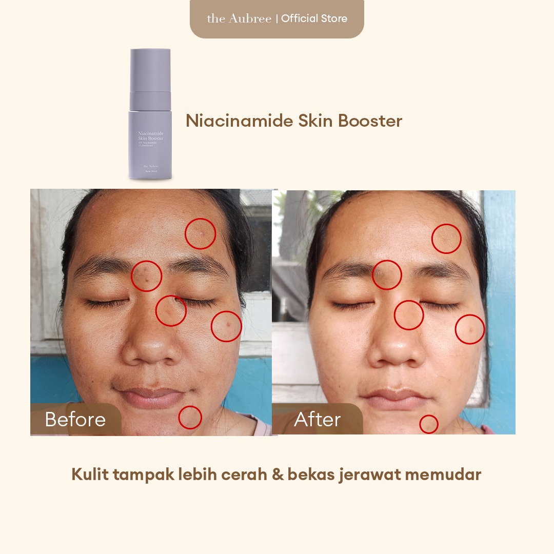 The Aubree Niacinamide Skin Booster 30mL Serum Pencerah Wajah