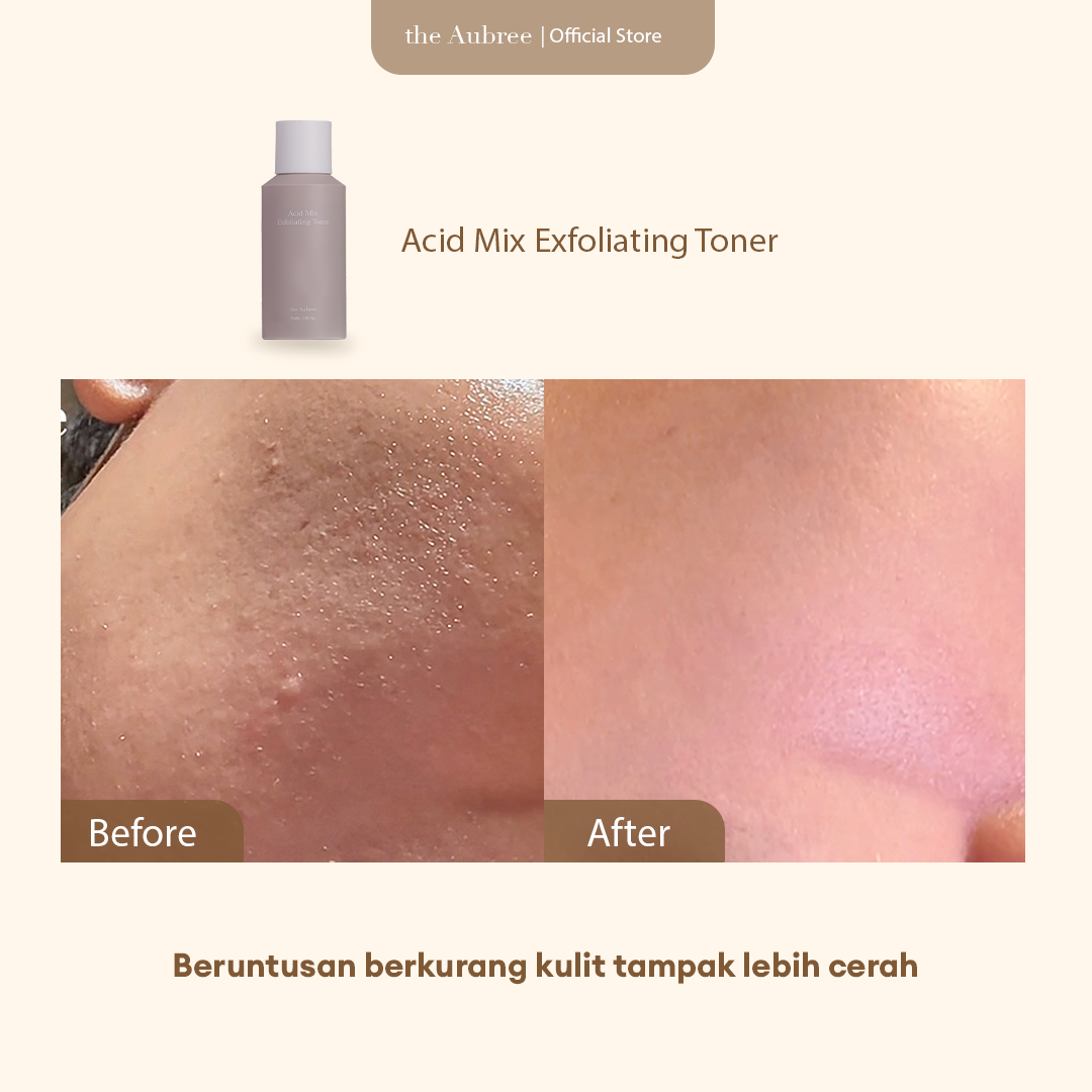 The Aubree Acid Mix Exfoliating Toner 100 ml Toner Pencerah Wajah