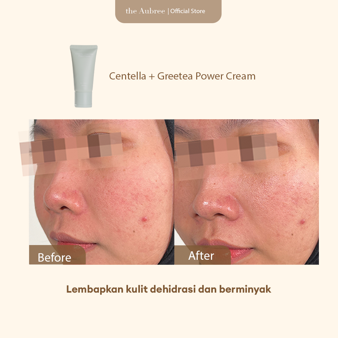 The Aubree Centella + Greentea Power Cream New Formula 40gr Pelembap Kulit Berminyak