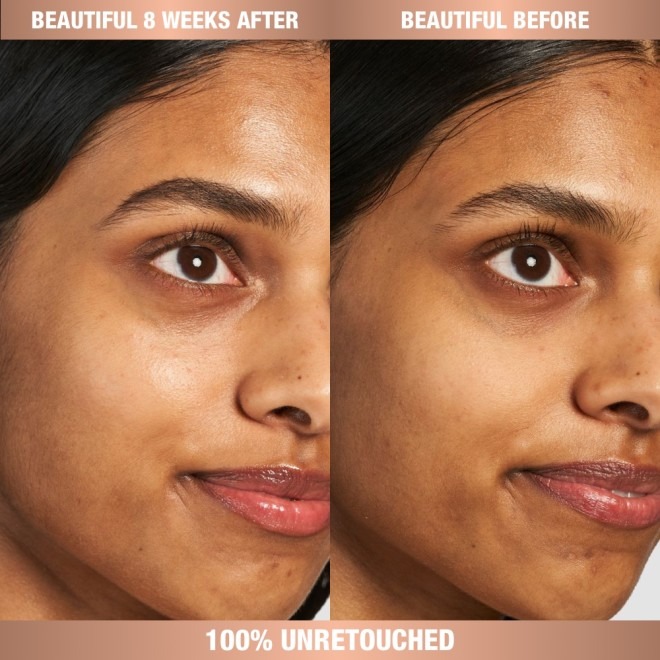 Charlotte's Tilbury MAGIC EYE RESCUE